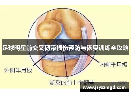 足球明星前交叉韧带损伤预防与恢复训练全攻略